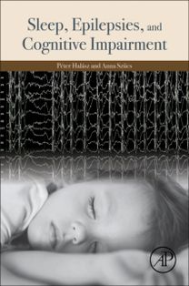 Sleep, Epilepsies, and Cognitive Impairment Sleep, Epilepsies, and Cognitive Impairment