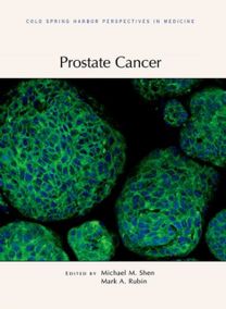 Prostate Cancer Prostate Cancer
