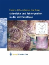 Fallstricke Und Fehlerquellen in Der De