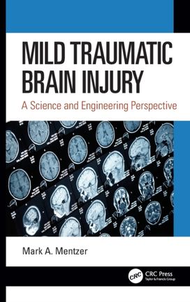 Mild Traumatic Brain Injury Mild Traumatic Brain Injury
