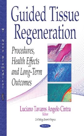 Guided Tissue Regeneration Guided Tissue Regeneration