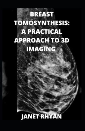 Breast Tomosynthesis Breast Tomosynthesis